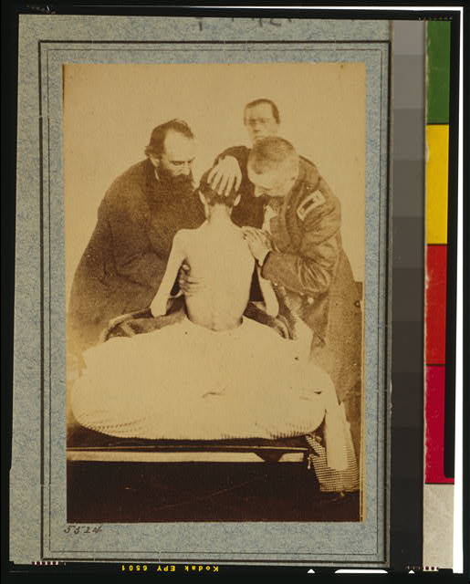 Civil War POW examined by doctors
